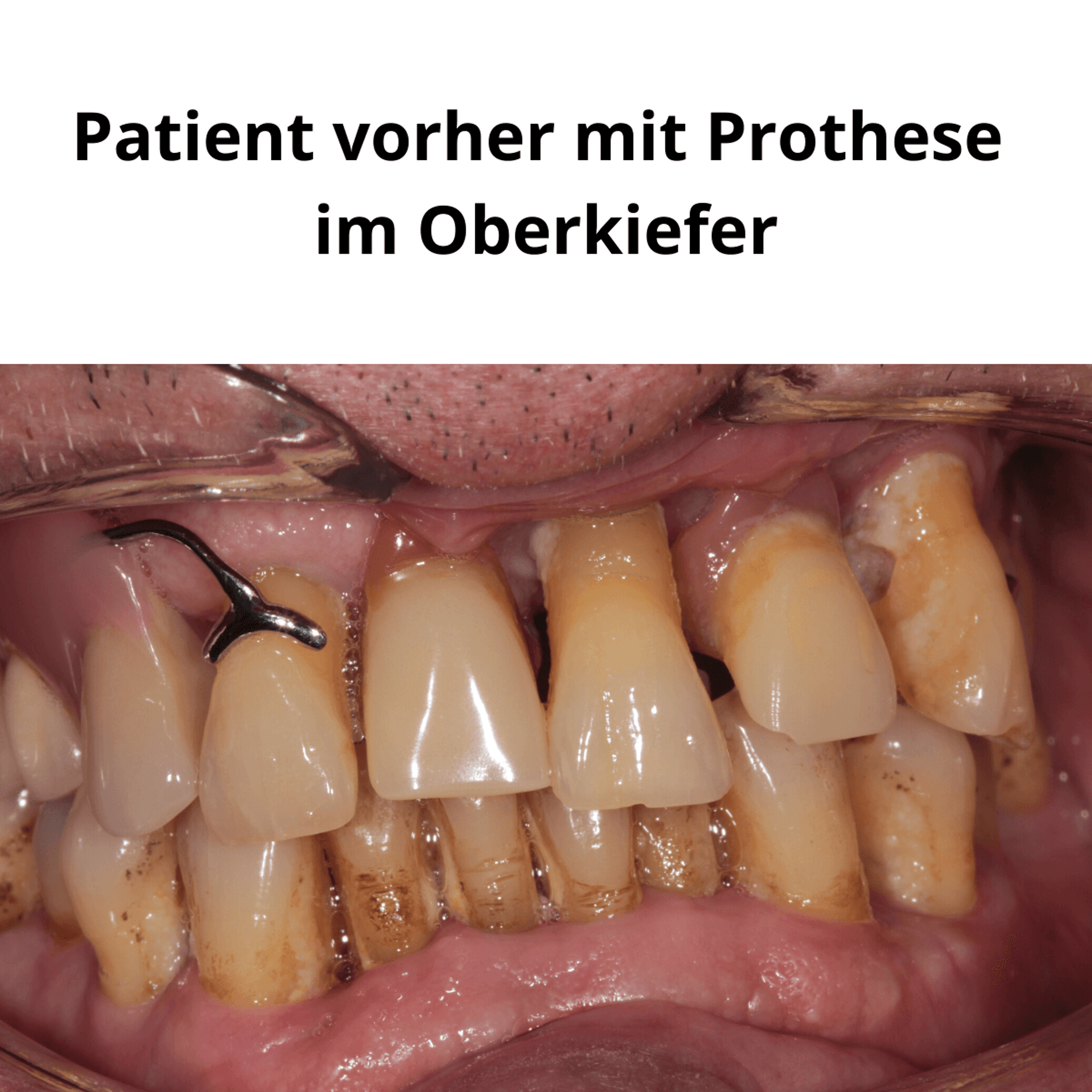 Patientenfall vorher/nachher