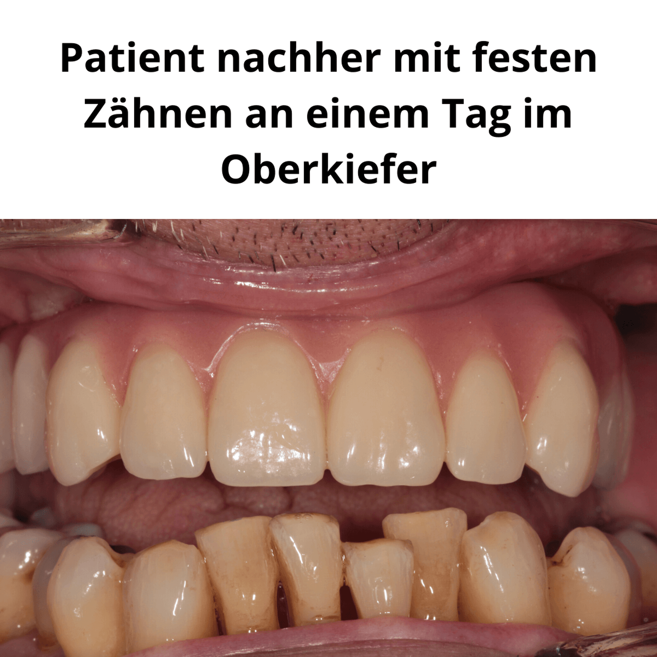Patientenfall vorher/nachher