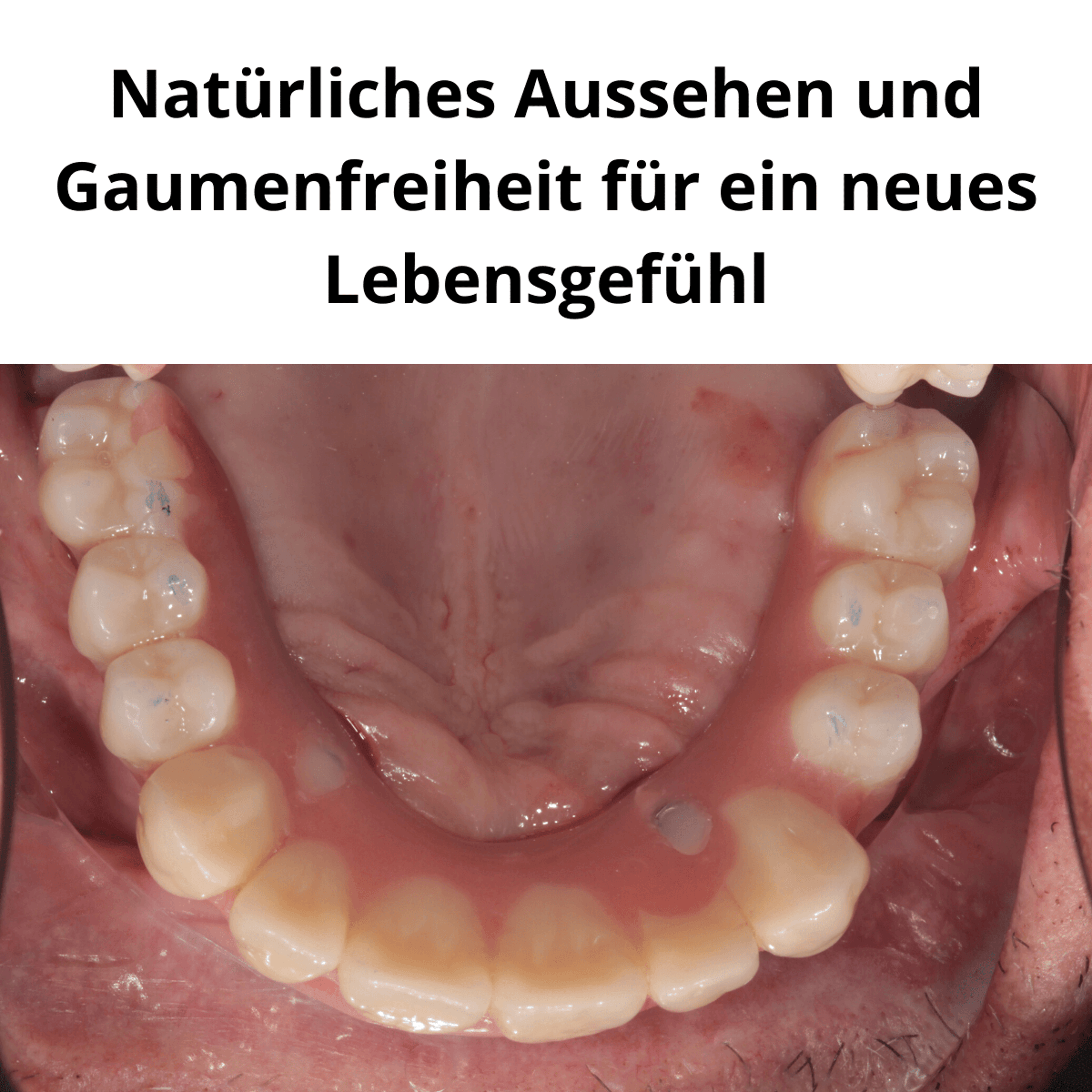 Patientenfall vorher/nachher