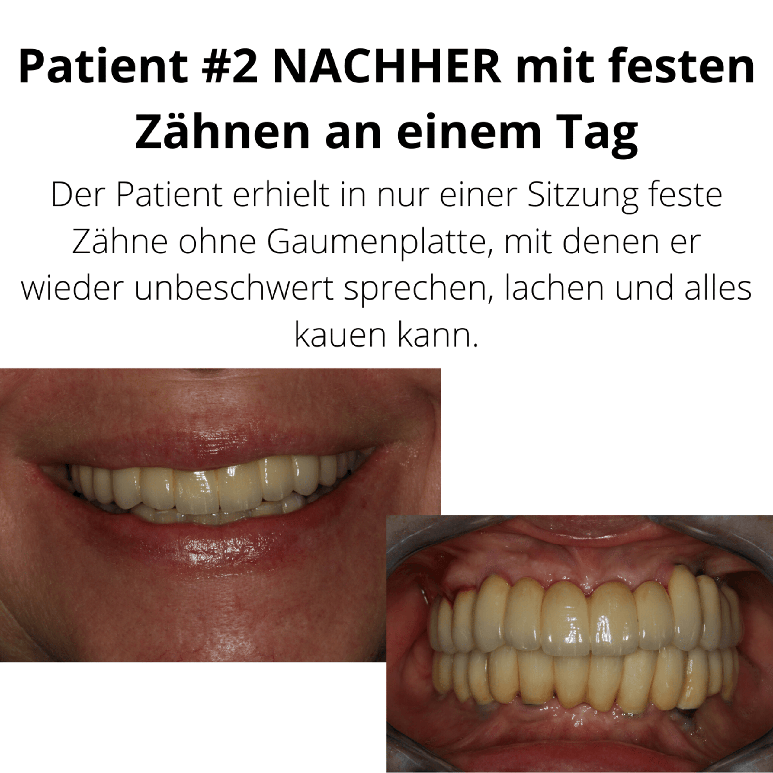 Patientenfall vorher/nachher