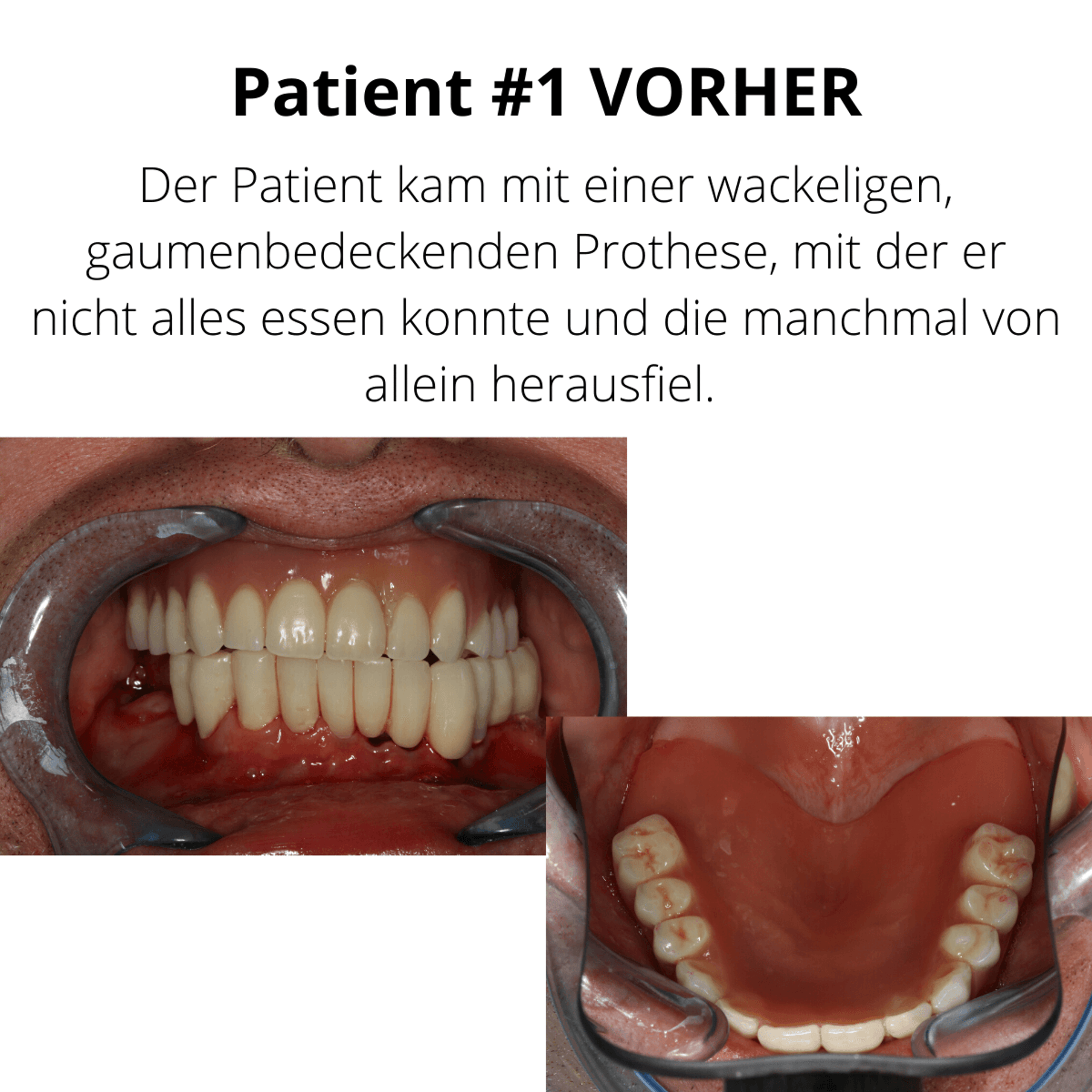 Patientenfall vorher/nachher