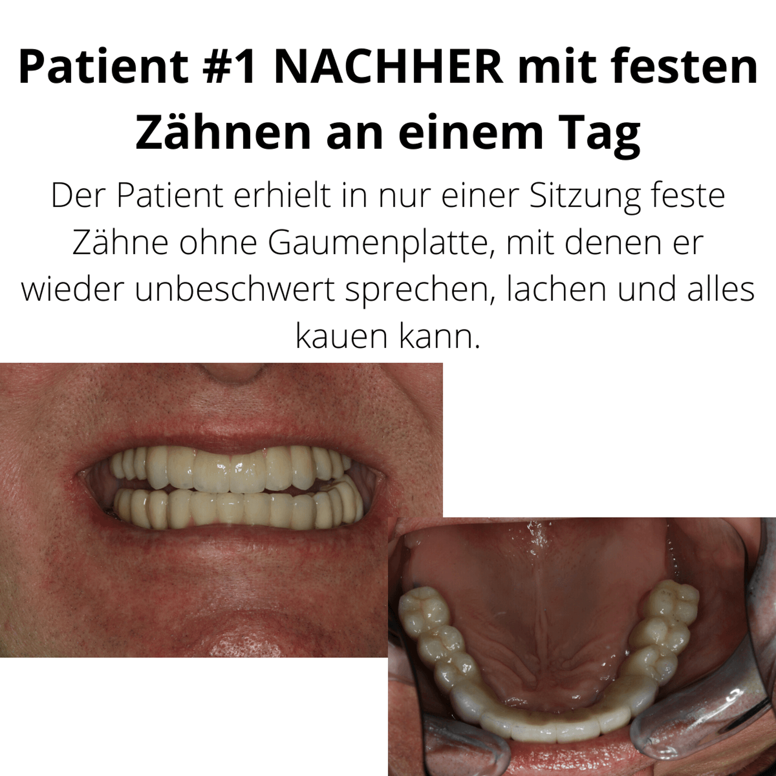Patientenfall vorher/nachher