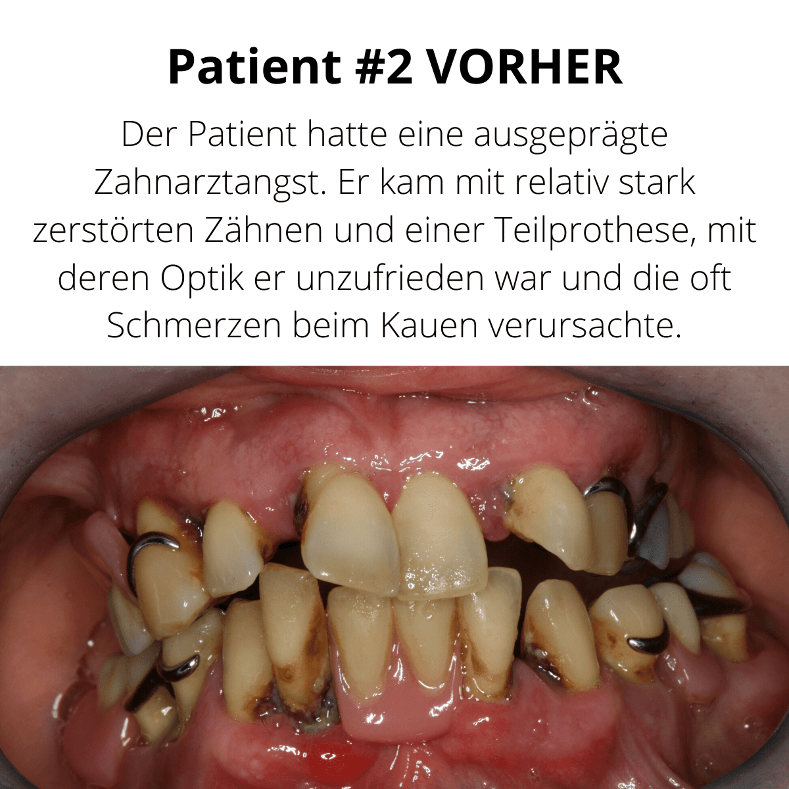 Patientenfall vorher/nachher